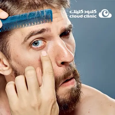 هل ينمو شعر الحواجب بعد سقوطه